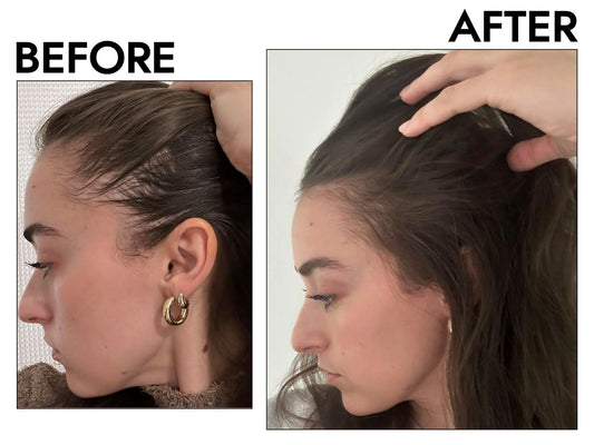 Are_hair_loss_treatments_safe_for_women