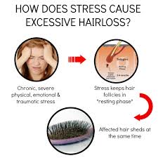 Can_stress_cause_hair_loss