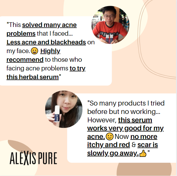 Alexis Pure Toco-Liftonin ARB Extra Strength Face Serum For Acne, Acne Scars, Minimize Pores, Oily/Greasy Skin, Skin Brightening, Improve Skin Barrier, Moisturize Skin – 30ml