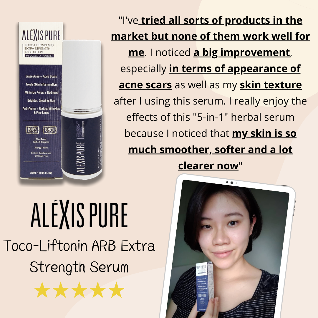 Alexis Pure Toco-Liftonin ARB Extra Strength Face Serum For Acne, Acne Scars, Minimize Pores, Oily/Greasy Skin, Skin Brightening, Improve Skin Barrier, Moisturize Skin – 30ml
