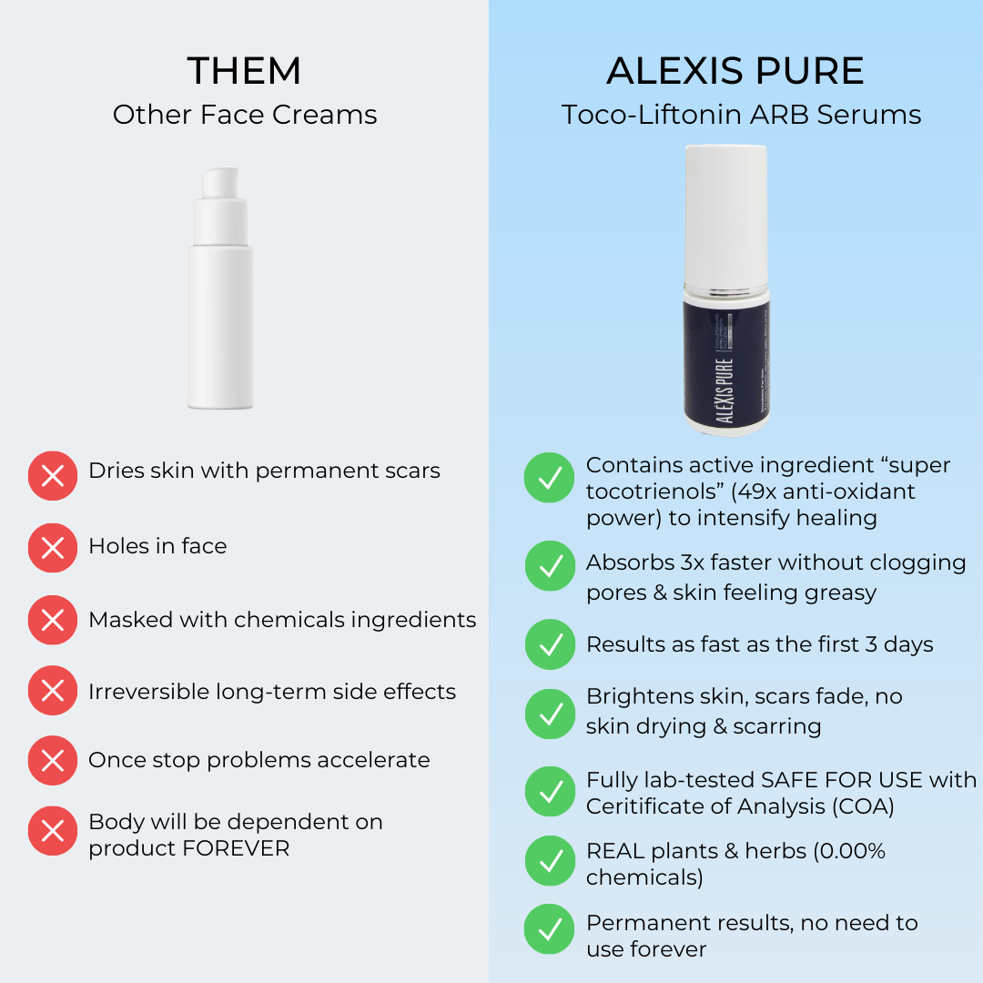 Alexis Pure Toco-Liftonin ARB Extra Strength Face Serum For Acne, Acne Scars, Minimize Pores, Oily/Greasy Skin, Skin Brightening, Improve Skin Barrier, Moisturize Skin – 30ml